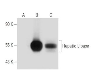 Hepatic Lipase Antibody (XHL3-6) - Western Blotting - Image 42005 
