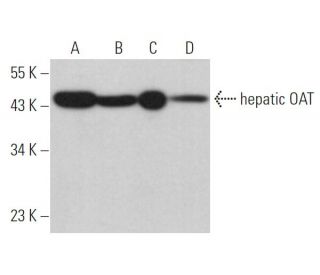 hepatic OAT Antibody (D-10) - Western Blotting - Image 366336 