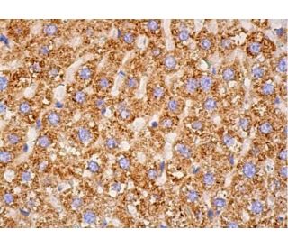 Hepatocyte Specific Antigen Antibody (OCH1E5) - Immunohistochemistry ...