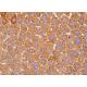 Hepatocyte Specific Antigen Antibody (OCH1E5) - Immunohistochemistry - Image 385396 