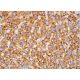 Hepatocyte Specific Antigen Antibody (OCH1E5) - Immunohistochemistry - Image 385397 