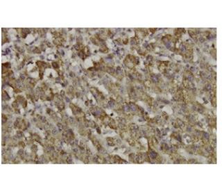 hepcidin Antibody (56-Z) - Immunohistochemistry - Image 35959