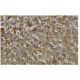 hepcidin Antibody (56-Z) - Immunohistochemistry - Image 35959