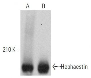 Hephaestin Antibody (C-7) - Western Blotting - Image 362538 