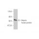 Hepsin Antibody (2D5) - Western Blotting - Image 348521