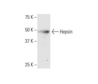 Hepsin Antibody (2D5) - Western Blotting - Image 352119 