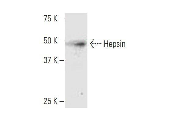 Hepsin抗体 (2D5) | SCBT - Santa Cruz Biotechnology