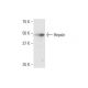 Hepsin Antibody (2D5) - Western Blotting - Image 352119 