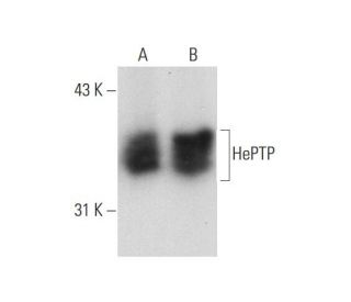 HePTP Antibody (E-5) - Western Blotting - Image 131228 