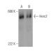 Herc2 Antibody (A-5) - Western Blotting - Image 371038 