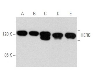 western blotting image from recommended HERG (F-12) monoclonal antibody replacement. Image 356642