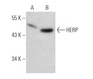 HERP Antibody (19-Y) - Western Blotting - Image 368198 