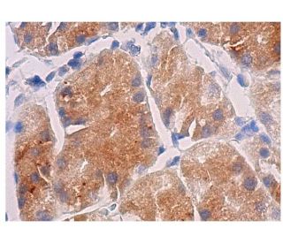 immunohistochemistry image from recommended HES1 (E-5) monoclonal antibody replacement. Image 281918