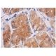immunohistochemistry image from recommended HES1 (E-5) monoclonal antibody replacement. Image 281918
