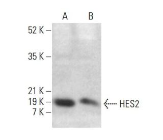 HES2 Antibody (H-8) - Western Blotting - Image 376229Each CRISPR/Cas9 Knockout (KO) Plasmid product consists of a pool of 3 plasmids designed to ensure identification and cleavage of a specific gene for maximum knockout efficiency. Each plasmid encodes a unique 20 nt sequence derived from the GeCKO (v2) library.