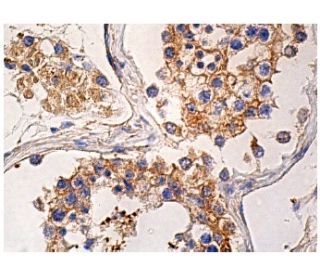 HES6 Antibody (F-5) - Immunohistochemistry - Image 157949 