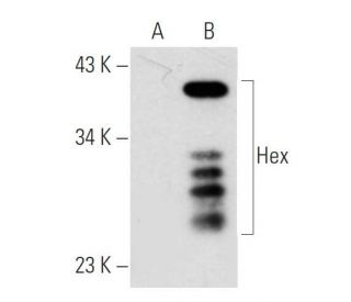 Hex Antibody (HHE5I261) - Western Blotting - Image 32912 