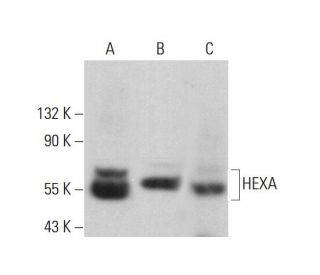HEXA Antibody (E-2) - Western Blotting - Image 376506 