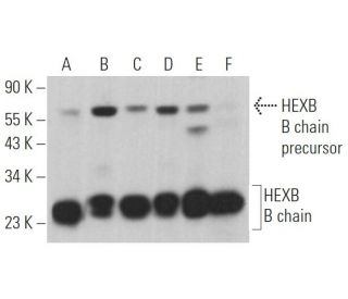 HEXB B chain Antibody (D-9) - Western Blotting - Image 362874 
