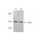 western blotting image from recommended HGFα (H-10) monoclonal antibody replacement. Image 353344