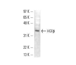 western blotting image from recommended HGF&beta; (SBF5 C1.7) monoclonal antibody replacement. Image 13594