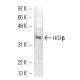 western blotting image from recommended HGFβ (SBF5 C1.7) monoclonal antibody replacement. Image 13594
