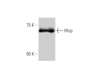 western blotting image from recommended Hhip (5D11) monoclonal antibody replacement. Image 347621