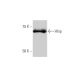 western blotting image from recommended Hhip (5D11) monoclonal antibody replacement. Image 347621
