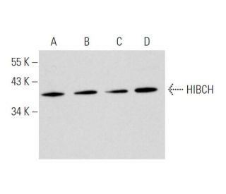 HIBCH Antibody (E-11) - Western Blotting - Image 345983 