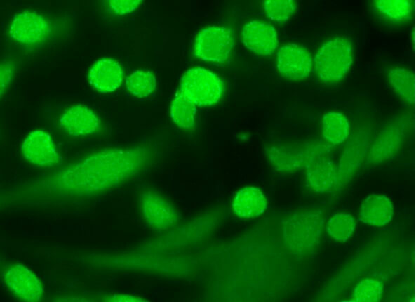 HIC-1抗体(H-6) | SCBT - Santa Cruz Biotechnology