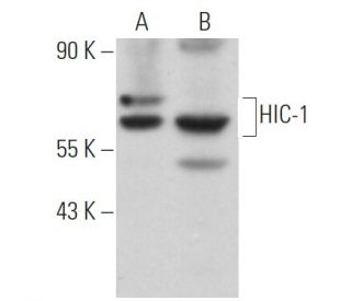 HIC-1 Antibody (H-6) | SCBT - Santa Cruz Biotechnology