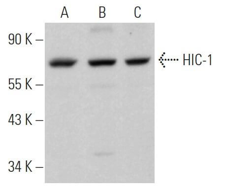 【 THP リキッド 1ml】 CBP CBD CBN CBG CRDH 楽天市場】超 CRDP 60% CBD CBN CBG サティバ ハイブリッド 1ml
