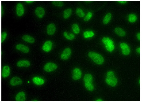 あ　H I F HIF1a抗体(28b) | SCBT - Santa Cruz Biotechnology