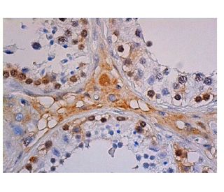 HIF1a Antibody (28b) - Immunohistochemistry - Image 348045 
