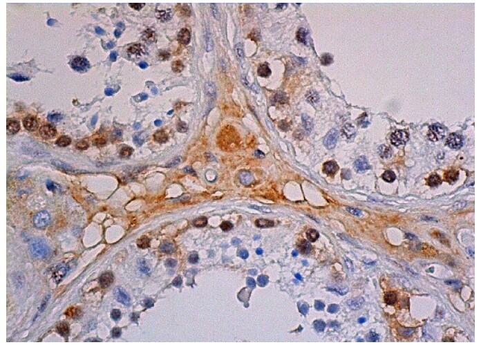 HIF1a Antibody (28b) | SCBT - Santa Cruz Biotechnology