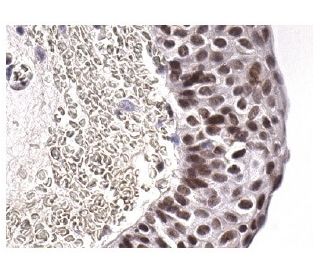 immunohistochemistry image from recommended HIF1a (28b) monoclonal antibody replacement. Image 156493