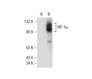 HIF-1 alpha (H1 alpha 67): sc-53546. Western blot analysis of HIF-1 alpha expression...
