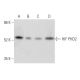 This polyclonal antibody has been discontinued. See our recommended <a href="hif-phd2-antibody-h-8">HIF PHD2 (H-8)</a> monoclonal antibody (sample data shown). western blotting image from recommended HIF PHD2 (H-8) monoclonal antibody replacement. Image 354870