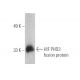 HIF PHD3 Antibody (EG188e/d5) - Western Blotting - Image 395152