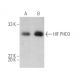 HIF PHD3 Antibody (EG188e/d5) - Western Blotting - Image 395153 