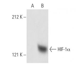 HIF1a Antibody (28b) - Western Blotting - Image 1210The Double Nickase Plasmid features a U6 promoter for sgRNA expression, a 20 nt targeting sequence, and a gRNA scaffold to guide Cas9n. It includes a CBh promoter for Cas9n (D10A) and puromycin resistance, GFP for transfection verification, and nuclear localization signals (NLS). The 2A peptide allows co-expression of Cas9n and Puro from a single promoter, enabling precise genome editing with reduced off-target effects.
