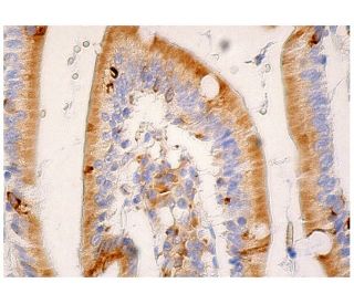 HIG2 Antibody (G-2) - Immunohistochemistry - Image 281092 
