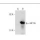 HIP-55 Antibody (7) - Western Blotting - Image 160353