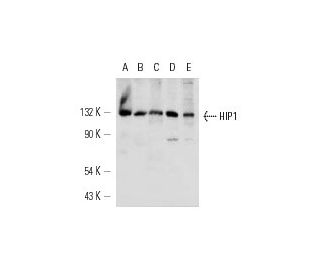 HIP1 Antibody (1B11) - Western Blotting - Image 12559 