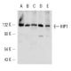 HIP1 Antibody (1B11) - Western Blotting - Image 12559 