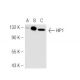 HIP1 Antibody (1B11) - Western Blotting - Image 46431