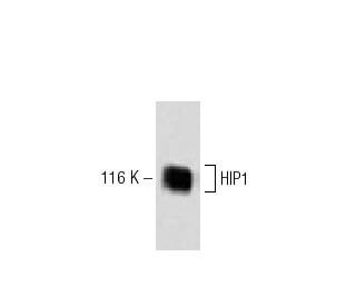 HIP1 Antibody (34) - Western Blotting - Image 60307