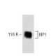HIP1 Antibody (34) - Western Blotting - Image 60307