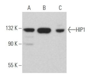 HIP1 Antibody (4B10) - Western Blotting - Image 363901 