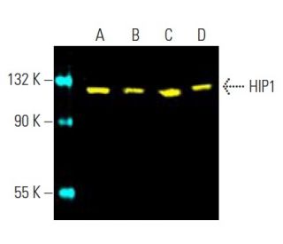 HIP1 Antibody (4B10) - Western Blotting - Image 396452